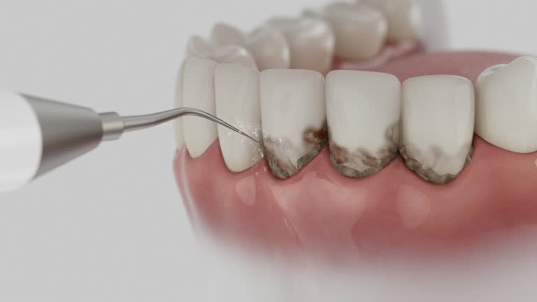 Reliable Dental contractor in Little Canada, MN by Dentist Open Now